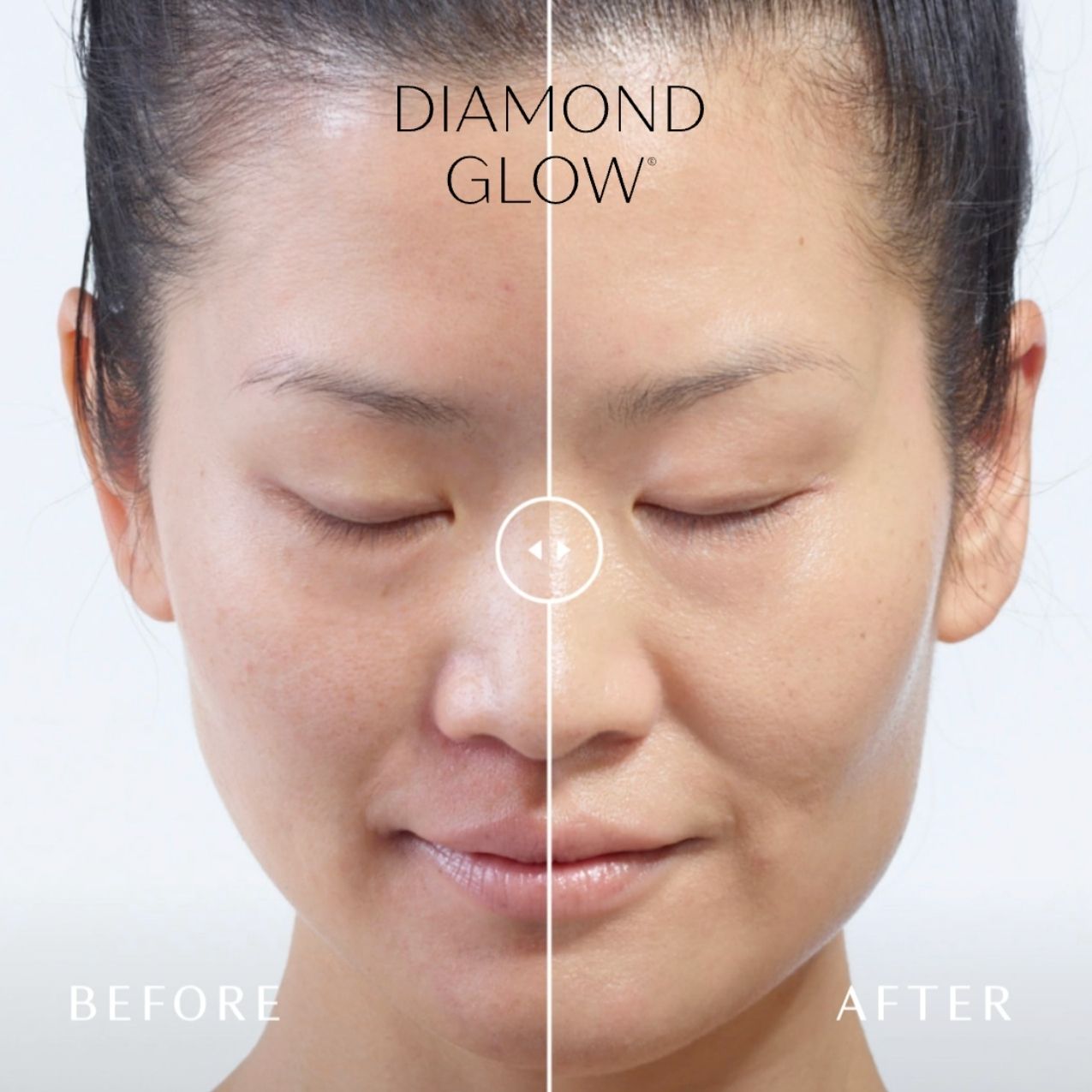 Before and after DiamondGlow facial results at The VISTA Med Spa. Split image of a woman’s face: left side before treatment with dull, uneven tone; right side after treatment with smoother, brighter, and more radiant skin.